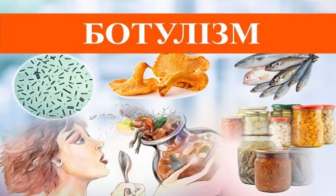 Ботулізм: лікарі борються за життя пацієнта